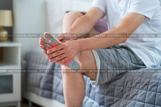 Joint diseases, hallux valgus, plantar fasciitis, man's leg hurts, pain in the foot. Стоковое фото, фотограф Станислав Тарко / Фотобанк Лори