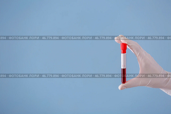 Лаборант держит пробирку с образцом крови на цветном фоне. Стоковое фото, фотограф Pixel_shot / Фотобанк Лори