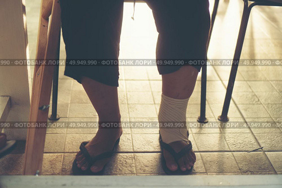 Legs of patients wearing a splint. Стоковое фото, агентство Ingram Publishing / Фотобанк Лори