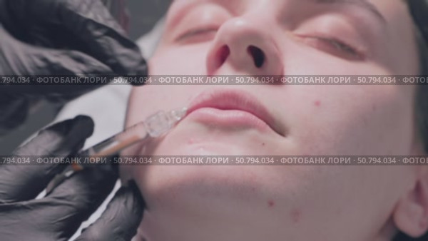 Lip Enhancement Procedure using Injectable Filler for aesthetic improvements and beauty. Стоковое видео, видеограф Olesia Kondrateva / Фотобанк Лори