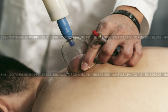 man suction cups session 2. Resolution and high quality beautiful photo. man suction cups session 2. High quality beautiful photo concept. Стоковое фото, агентство Ingram Publishing / Фотобанк Лори