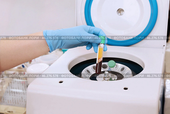 Medical tube with blood plasma in hand for PRP, extracted from centrifuge for plasma lifting. Стоковое фото, фотограф Ольга Зиновская / Фотобанк Лори