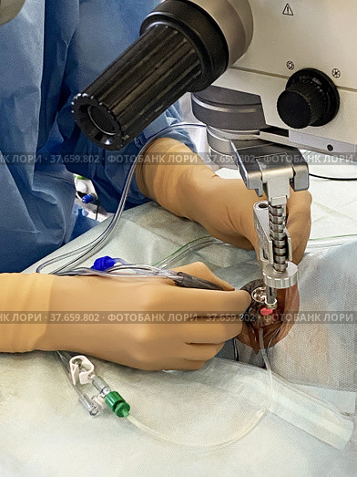 Ophthalmologist performs a complex operation to restore the cornea of eye. Doctor looks through microscope and works with a scalpel. Стоковое фото, фотограф Евгений Ткачёв / Фотобанк Лори
