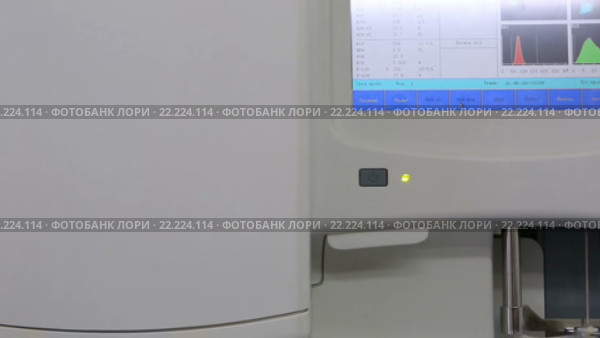 Современный высокопроизводительный автоматический гематологический анализатор с автопогрузчиком (2016 год). Редакционное видео, видеограф Юлия Машкова / Фотобанк Лори