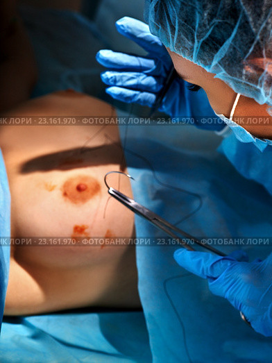 Surgeon operates women's breasts . Стоковое фото, фотограф Gennadiy Poznyakov / Фотобанк Лори