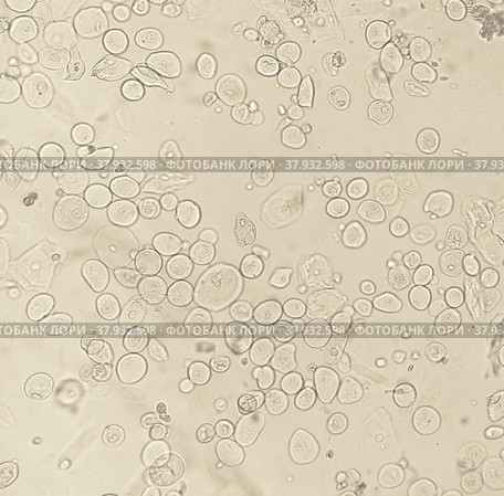 Transitional epithelium of a bladder. Стоковое фото, фотограф Вероника Веребрюсова / Фотобанк Лори