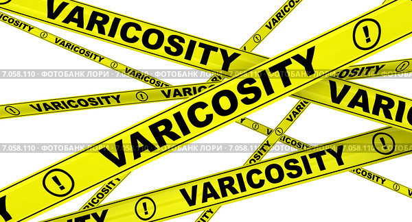 Варикоз (varicosity). Желтая оградительная лента. Стоковая иллюстрация, иллюстратор WalDeMarus / Фотобанк Лори
