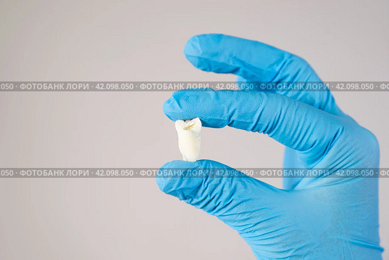 Wisdom teeth extraction, close-up tooth on gloved hand on gray background. Стоковое фото, фотограф Станислав Тарко / Фотобанк Лори